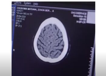 Oncoservice lanza nuevo servicio en #MedicinaNuclear PET-CEREBRAL.