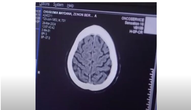 Oncoservice lanza nuevo servicio en #MedicinaNuclear PET-CEREBRAL.